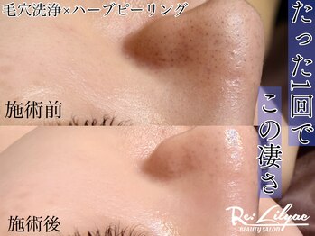 リリアック(Re:Lilyac)