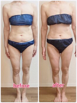 リナル 祐天寺店/120分☆痩身マシン＋全身リンパ