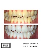 レオン 磐田(REON)/◇ お客様 before＆after ◇