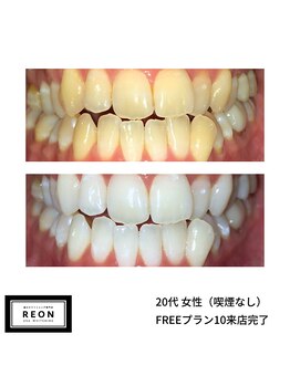 レオン 磐田(REON)/◇ お客様 before＆after ◇