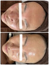 サロン ワン(salon one)/韓国セルマン導入　男性可