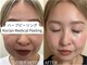 ルーヴレ(LUVRE)の写真/お肌に悩んでる方は是非ご来店下さい！効果絶大の韓国式ピーリング♪