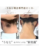 ミース 豊田店/うなじ矯正◆ビフォーアフター