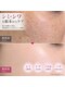 ラー(La)の写真/【看護師施術】何をしても満足できなかった年齢肌へ。シミ・しわ・くすみ・たるみを徹底集中ケア