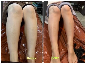 エステティックサロン ルティエ(RUTIE)/