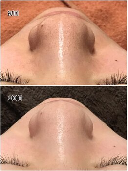 ベベ 高崎本店(Be'be')/Before After