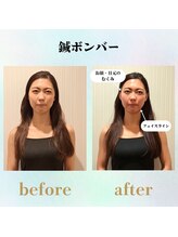 ラ コンシェル 代々木上原店/大人気鍼ボンバー！お客様の結果