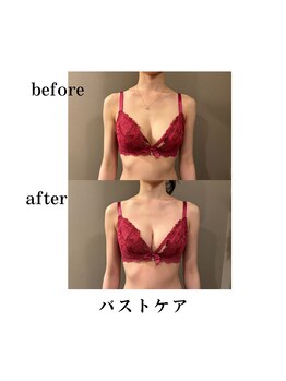 エステティックレイビス 弘前店(RAYVIS)/