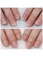WRネイルズ(WR Nails) 爪のコンプレックスとお別れ