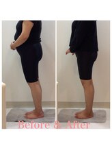 スタイルラボ高松/産後骨盤矯正の効果♪