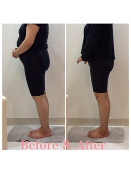 スタイルラボ高松/産後骨盤矯正の効果♪