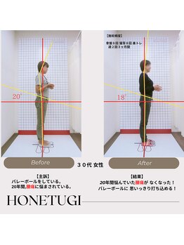 ほねつぎ総社 はりきゅう接骨院/成果/慢性腰痛