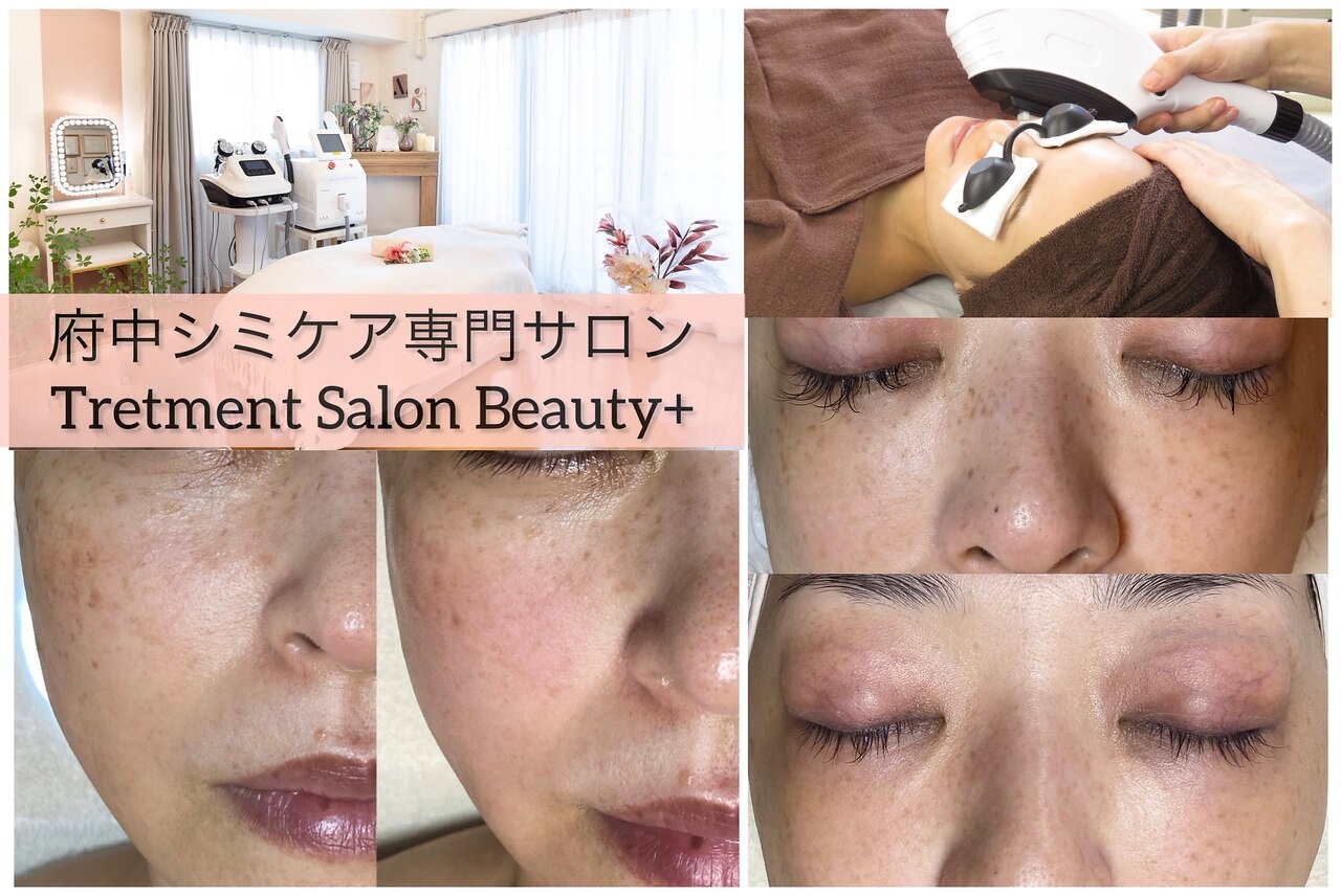 エステツン　プラズマビューティー トリートメントサロンビューティープラス(Treatment Salon Beauty+)