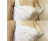 カール(curl)の雰囲気（デコルテからふっくら！お肉が少ない方も1回で驚きの違いが！）