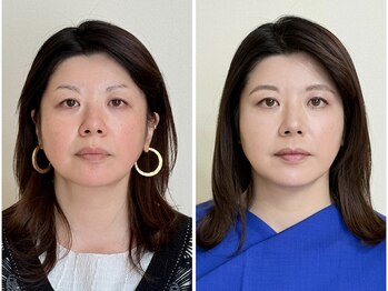 シキサイ 千葉船橋(SIKI-SAI)/トータル診断＋メイクレッスン