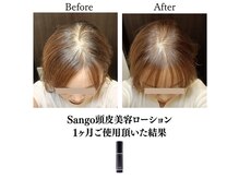 ララスマイル 鶴崎森町店/美髪プログラム(髪頭皮のお悩み)
