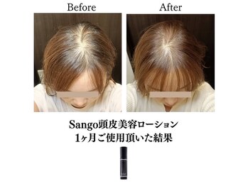 ララスマイル 鶴崎森町店/美髪プログラム(髪頭皮のお悩み)