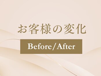 心穏はり灸 整体院/Before & After