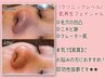 【素肌美人】ニキビケア・凹凸毛穴・黒ずみ毛穴 医療レベルケア