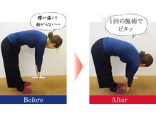 さんちゃ整体院/【一回でこんなに改善！】