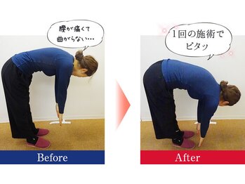 さんちゃ整体院/【一回でこんなに改善！】