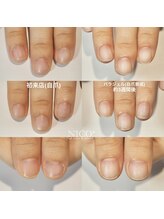 ニコプラス(NICO+)/自爪育成中