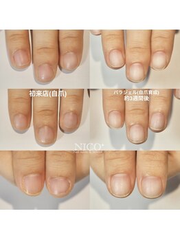 ニコプラス(NICO+)/自爪育成中