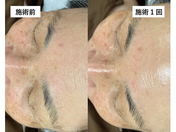 エトワール(etoile)/【エイジングケアに特化】