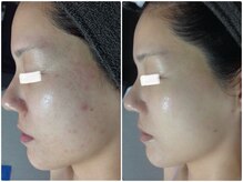 ルノン(LUNON)/ビフォーアフター集