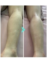 ミルキー(Milky)/膝が痛い事放置していませんか？