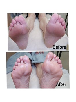 リゼラアンドコー 水戸店/ドイツ式フットケア専門店