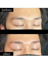 ユー 千葉駅前店(you)/ビフォーアフター写真