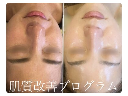 ミミルーチェ(mimiluce)の写真