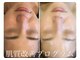 ミミルーチェ(mimiluce)の写真