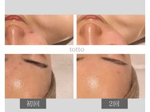 サロントット(salon totto)の雰囲気(オーダーメイドハーブピーリング/フォトUP中★)