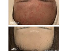 フェリーチェ(Felice)の雰囲気（剥離なし/剥離ありのピーリング◎選べる結果重視の肌質改善！）