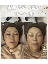 アイリー(IRIE)/サーマル