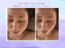 サロン タエン/くすみ解消！艶肌インディバ