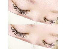 オルカ(Orca)/バインドロック120本