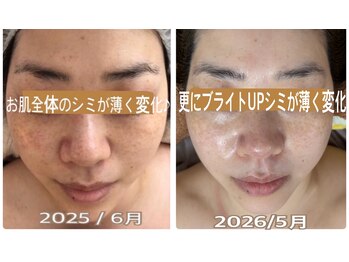 アルページュ(Arpege)/韓国女優肌★色白シミケア人気中