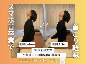 ルルラボ(LuLu beauty labo)/スマホ首卒業で軽やかな首元へ