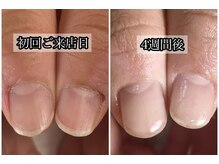 プレシャスハート 広島(Precious Heart)/◆育成◆お爪の経過写真