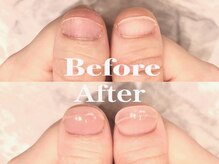 オー 町田モディ店(Oh!)/深爪矯正爪育成♪メンズも◎冬色