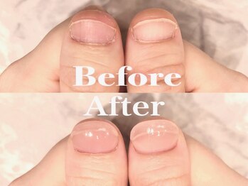 深爪矯正爪育成♪メンズも◎冬色