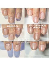 ニコプラス(NICO+)/自爪育成中(自爪風)
