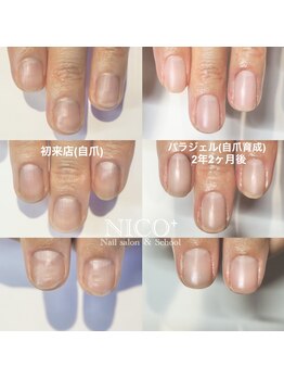 ニコプラス(NICO+)/自爪育成中(自爪風)