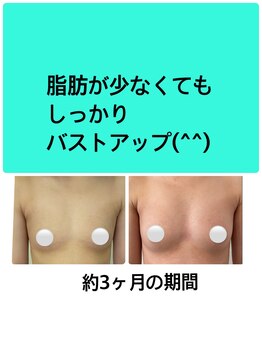 ビサンテ(Vi sante)/バストアップ