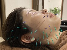 フォーゼ鍼灸整骨院