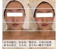 ナラビューティー(NARA BEAUTY)