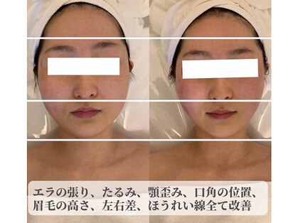 ナラビューティー(NARA BEAUTY)の写真